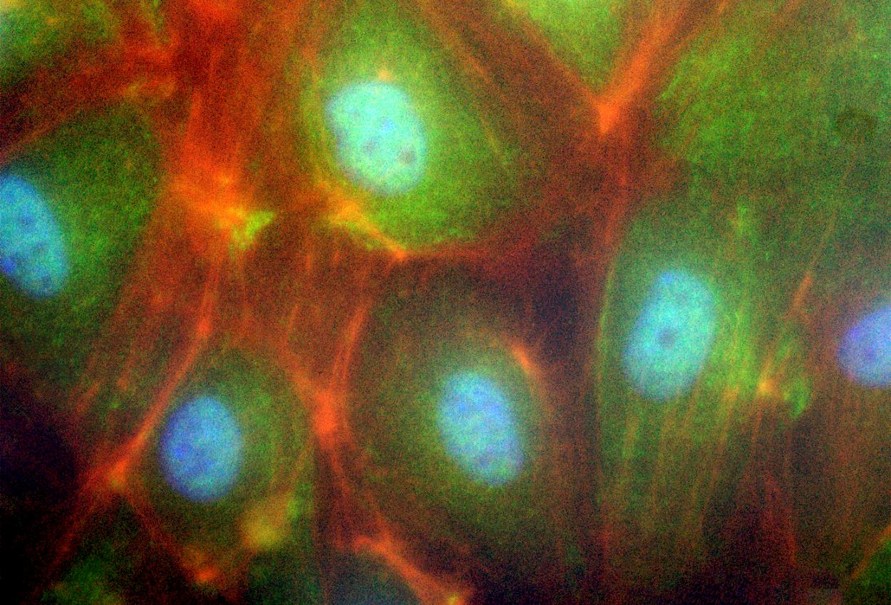 Im Fluoreszenzmikroskop: Zu sehen ist eine Immunfluoreszenzfärbung von menschlichen Endothelzellen, wobei der Zellkern blau ist, bestimmte Zellplasmamarker (genauer Bestandteile des Zellskelets) sind rot und das Protein hnRNPU ist grün dargestellt.
